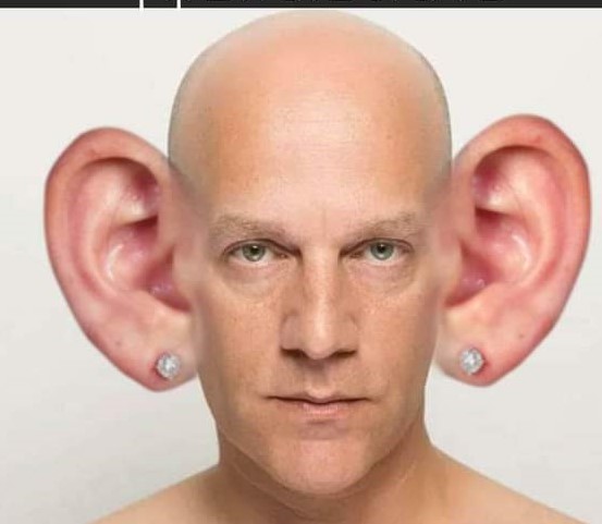 גיא פלג עשה ניתוח להגדלת שמיעה באזניים וחתכו לו את האונה במוח